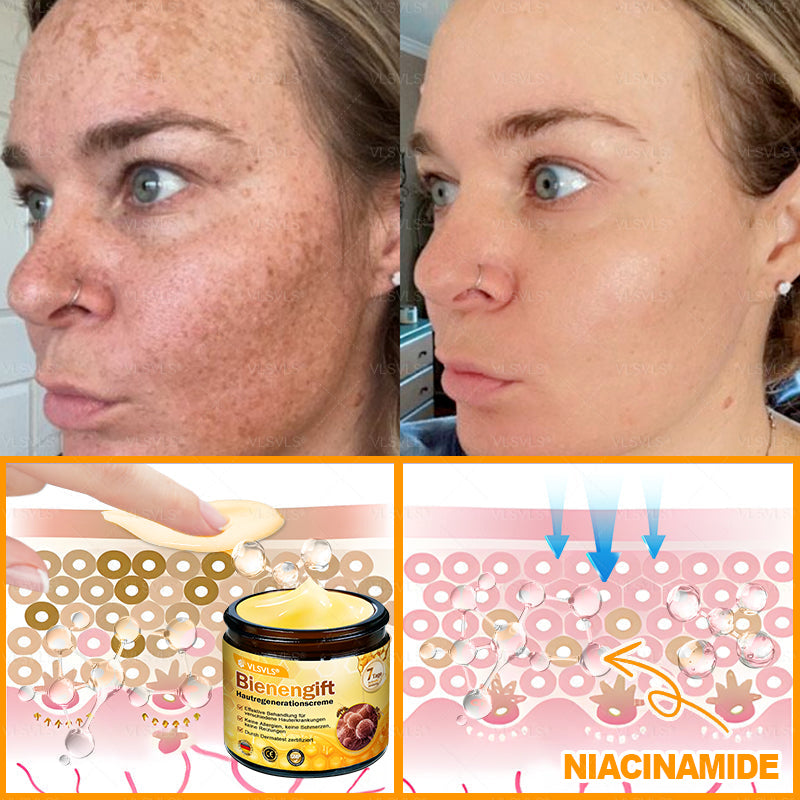 Hergestellt und versendet aus Deutschland ✨ VLSVLS® Bienengift Hautregenerationscreme 🔥 LETZTER TAG 80 % RABATT