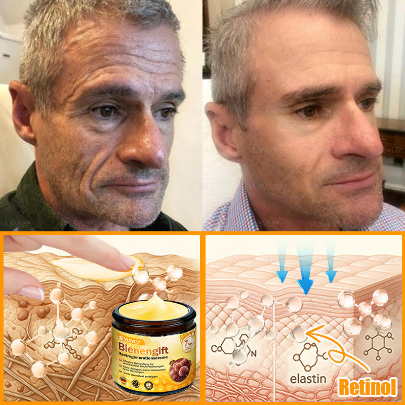 Hergestellt und versendet aus Deutschland ✨ VLSVLS® Bienengift Hautregenerationscreme 🔥 LETZTER TAG 80 % RABATT
