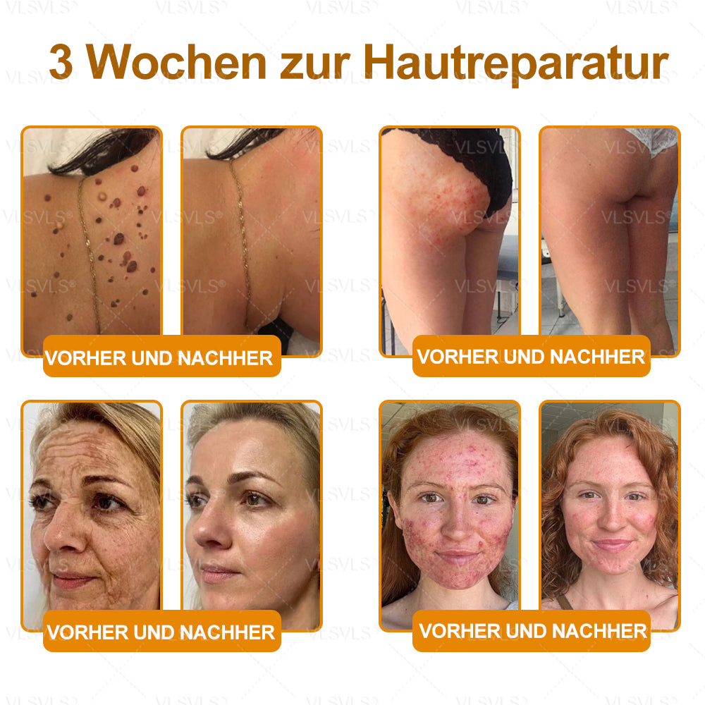 Hergestellt und versendet aus Deutschland ✨ VLSVLS® Bienengift Hautregenerationscreme 🔥 LETZTER TAG 80 % RABATT