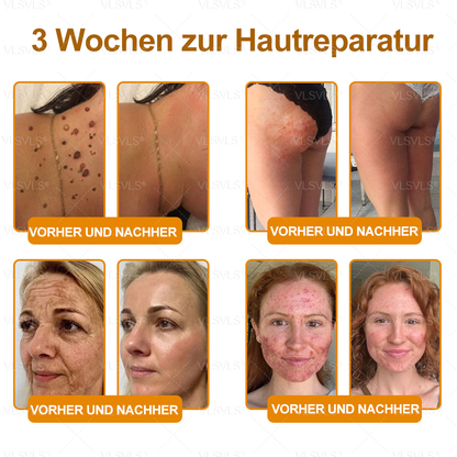 Hergestellt und versendet aus Deutschland ✨ VLSVLS® Bienengift Hautregenerationscreme 🔥 LETZTER TAG 80 % RABATT