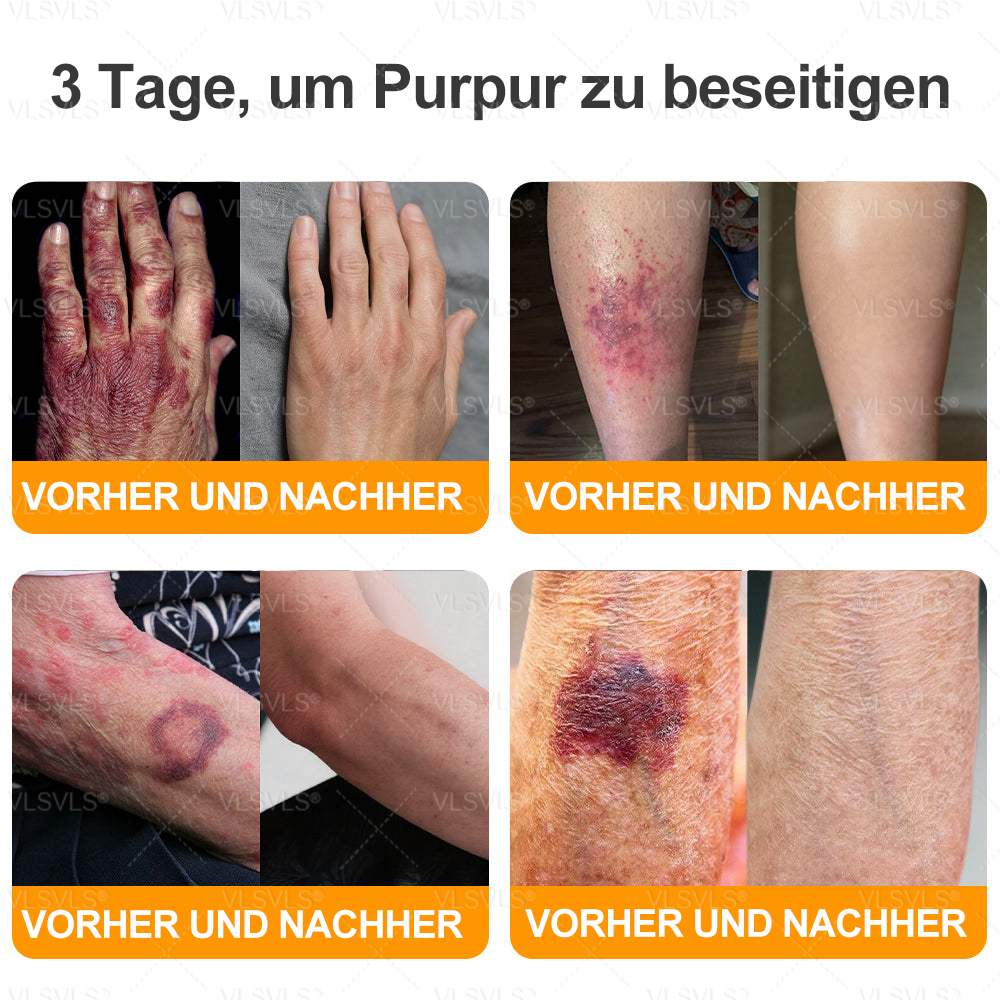 Hergestellt und versendet aus Deutschland ✨ VLSVLS® Bienengift Hautregenerationscreme 🔥 LETZTER TAG 80 % RABATT