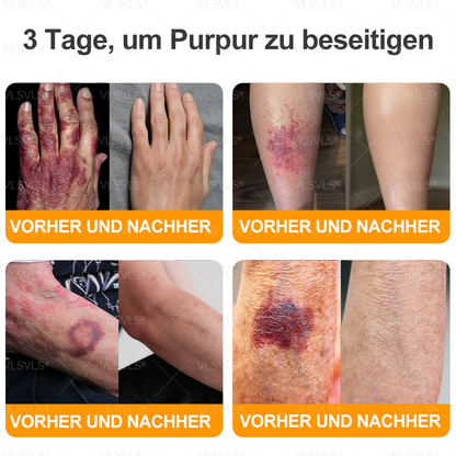 Hergestellt und versendet aus Deutschland ✨ VLSVLS® Bienengift Hautregenerationscreme 🔥 LETZTER TAG 80 % RABATT