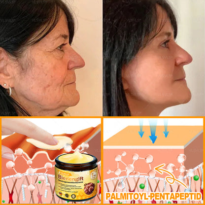 Hergestellt und versendet aus Deutschland ✨ VLSVLS® Bienengift Hautregenerationscreme 🔥 LETZTER TAG 80 % RABATT